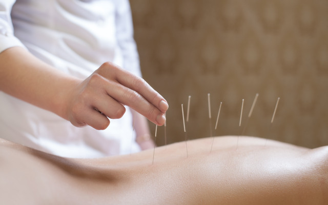 Acupuncture is a relaxing option for a variety of ailments.