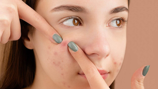 how to stop skin picking