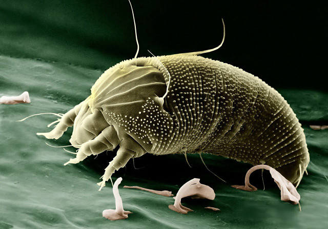 Mites are hard to spot, but regular cleaning helps reduce their numbers.