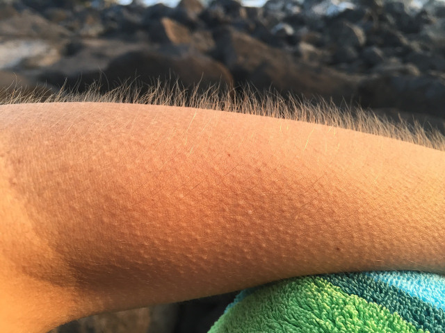 Goosebumps help create an insulating layer on your body. 