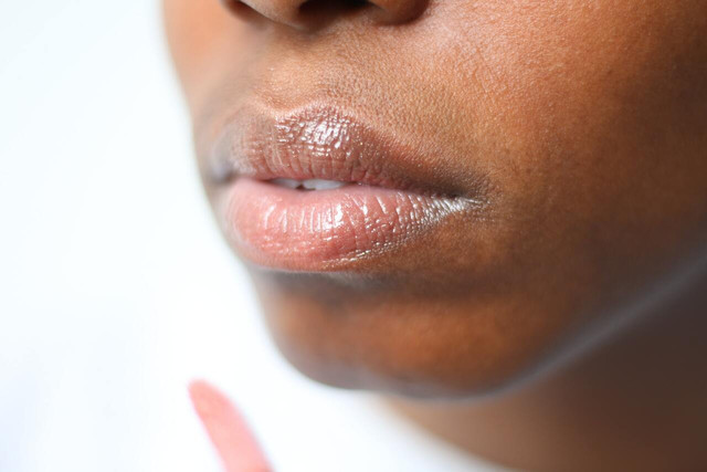 Lip balm is a great treatment for chapped lips.